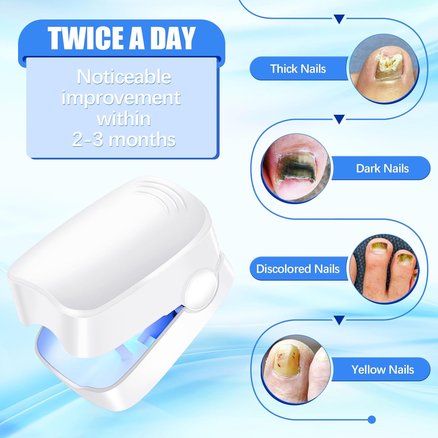 Rechargeable Nail Fungus Treatment for Toenail, Toe Nail Fungal Treatment Nail F - 12915_nail_fungus_cleaning_device