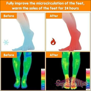 Before and after graphic: blue foot with snowflake vs red foot with flame; thermal scans show increased foot warmth.