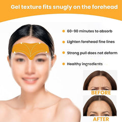 Forehead Wrinkle Patches Face Wrinkle Patches (10 Pcs Set) - Superior eMart