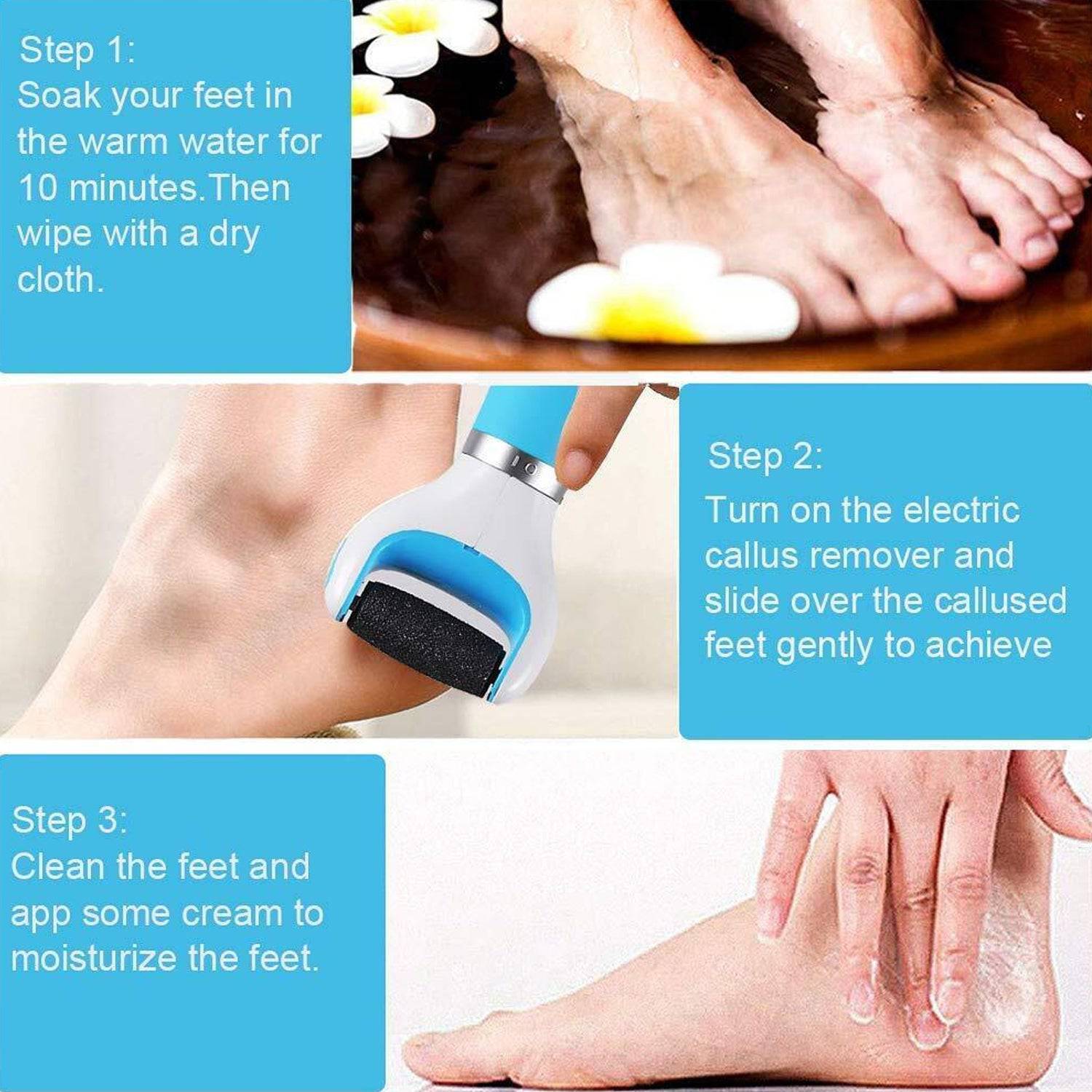 0229 Electronic Dry Foot File Callous Remover For Feet Electric Foot With Roller Hard And Dead Skin- Regular Coarse Baby Smooth Feet In Minutes. For In Home Padicure Foot Care Battery Powered  Usb (Battry Not Included) - Superior eMart